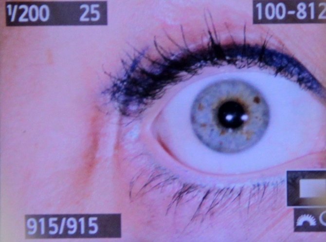 Parmak Izi Gibi Essiz Olan Iris Fotografi Buyuk Ilgi Goruyor