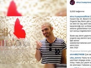 Elnur, Organik Saç Ekimi Sayesinde Beresini Çıkardı