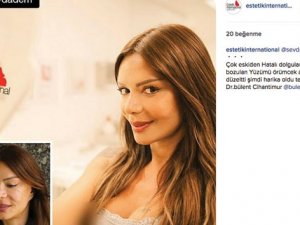 Sevda Demirel Örümcek Ağı Estetiği Yaptırdı