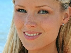 Güneş Lekelerinden “Maske Peeling” İle Kurtulun