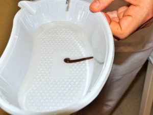 Burnundan Çıkana İnanamadı