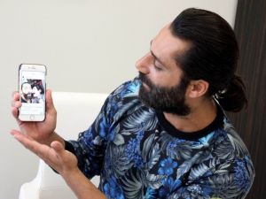 Survivor’dan sonraki ilk işi burnunu düzeltmek oldu