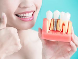 Başarılı implant için kemik kalitesi önemli