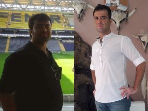 Tüp mide ameliyatıyla 42 kilo verdi