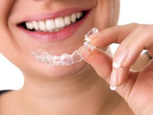 Invisalign tedavisi hakkında bilinmesi gereken 12 nokta