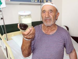 Mesanesinden 120 gram taş çıktı