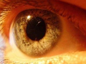 Sarı nokta hastalığı görme kaybı sebebi