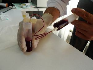 “Diz kireçlenmesinin tedavisi kendi kanımızda gizli”