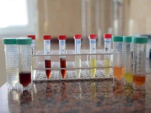 Elektronik sigarada gizli tehlike: Aroma