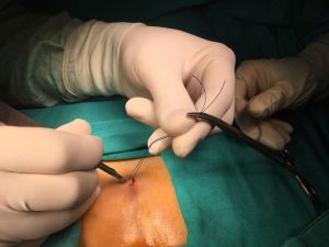 Bilgisayar bağımlılığı kıl dönmesine de neden oluyor