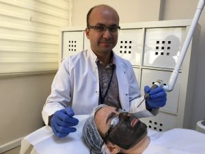 Cilt gençleştirmede kimyasal peeling yerine karbon peeling