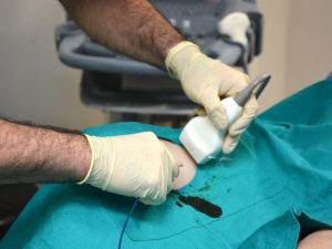 Variste ameliyatsız tedavi dönemi