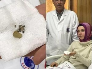 Burnundaki cisimle 24 yıl yaşadı