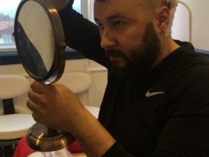 Saç ekim uzmanı, kendi saçını kendi ekti