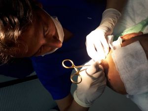 Saç ekiminde ’Çim adam’ olmayın