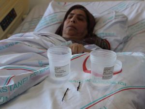 Vücudundaki iğneler 66 yıl sonra çıkarıldı