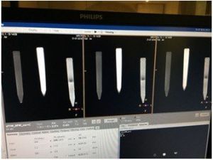 PAÜ Öğrencileri MRCP’de görüntü kalitesini artıran yüzde 100 doğal ürün tasarladı