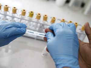 Konak Belediyesinden ücretsiz ve anonim HIV testi