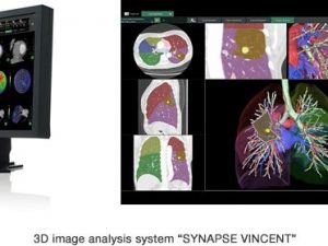 Görüntü analiz sistemine büyük ödül
