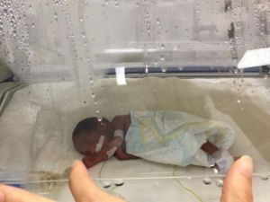 Üç düşükten sonra ’yaşamaz’ denilen 510 gramlık bebekten iyi haber