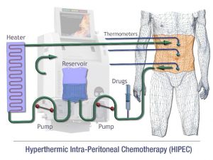"İnsanları gözle görülemeyen tümör hücreleri öldürüyor"