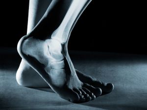 “Topuk ağrısını hafife almayın”