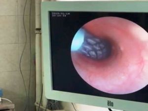 Türkiye’de ilk kez bir köpeğe stent takıldı