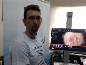 Türk Dermatoloji Derneğinin “ben taraması” hayat kurtarıyor