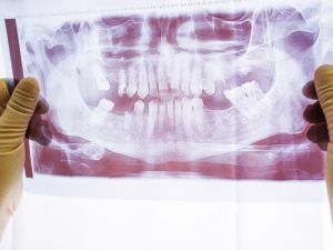 Dr. Öğr. Üyesi Ahmet Karaman “Çene Eklem Rahatsızlığı en çok kadınları etkiliyor”