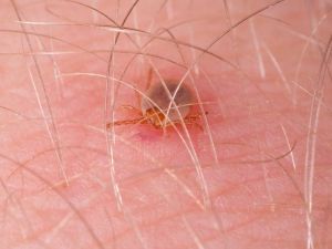 KKKA’da kene tutunmasında dikkatli olunmalı