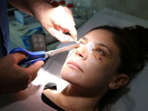 Estetik yaptırırken burnunuzdan olmayın