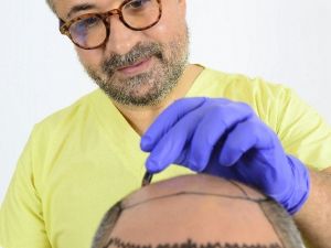 Saç ekimi ve estetikten gelen para 1 milyar doları geçti