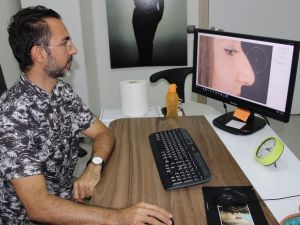 Burun estetiğinde Türkiye’ye ilgi artıyor