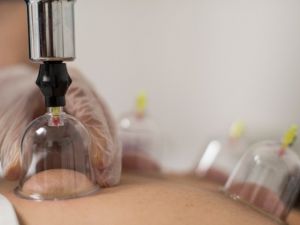 Beden saatini yeniden kurmanın anahtarı hacamat ve akupunkturda