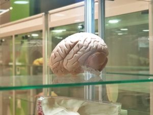 Beyin implantları hafızayı yüzde 20 arttırıyor