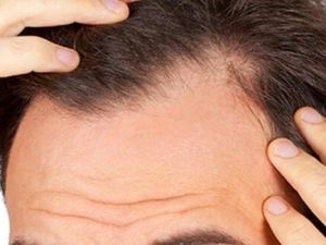 “Evde kalanlara” saç bakım önerileri