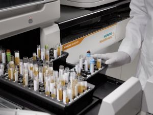 Koronavirüse karşı bağışıklık ölçen test