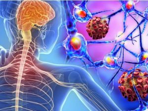 MS hastalarına Covid-19 uyarısı