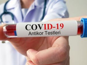 Emet’te 130 hanede antikor testi uygulaması başladı
