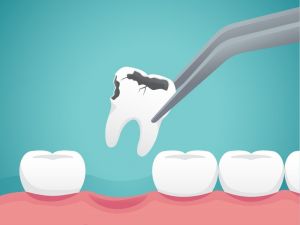 ’’Aşırı soda diş minesini aşındırabilir’’