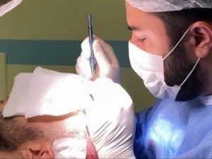 Million Hair Center CEO’su Fatih Köse: “Saç ekimi yaptırmak isteyenlerin sayısı artacak”