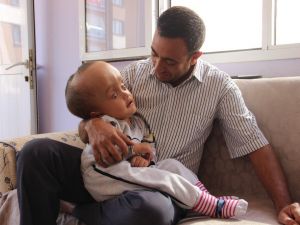 Minik Sercan’ın kafası küçülmeye başladı