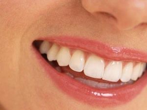 Ağız ve diş sağlığı psikolojiyi de etkiliyor