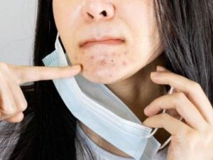 Maske kullanırken cilt sorunları nasıl önlenir?