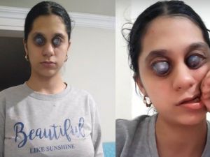 Ümran için Bakanlık harekete geçti