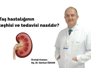 Taş hastalığına ses dalgası ve lazer çözümü