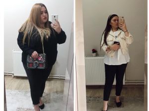Mide küçültme ameliyatı ile 9 ayda 58 kilo verdi