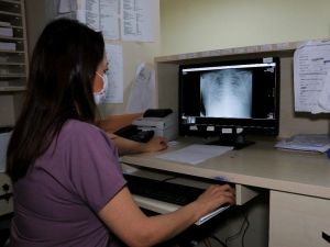 Koronalı hastaların akciğer röntgenleri korkuttu