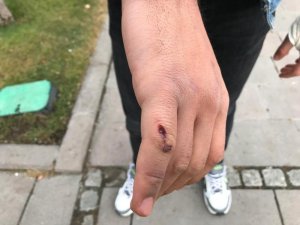 “Canım acıdı” denilerek darp edilen sağlıkçı o anları anlattı