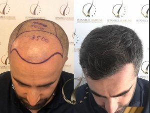 İstanbul Hairline CEO’su Gülşen Şener: “Çalışanlarımızı düzenli aralıklarla PCR testinden geçiriyoruz”